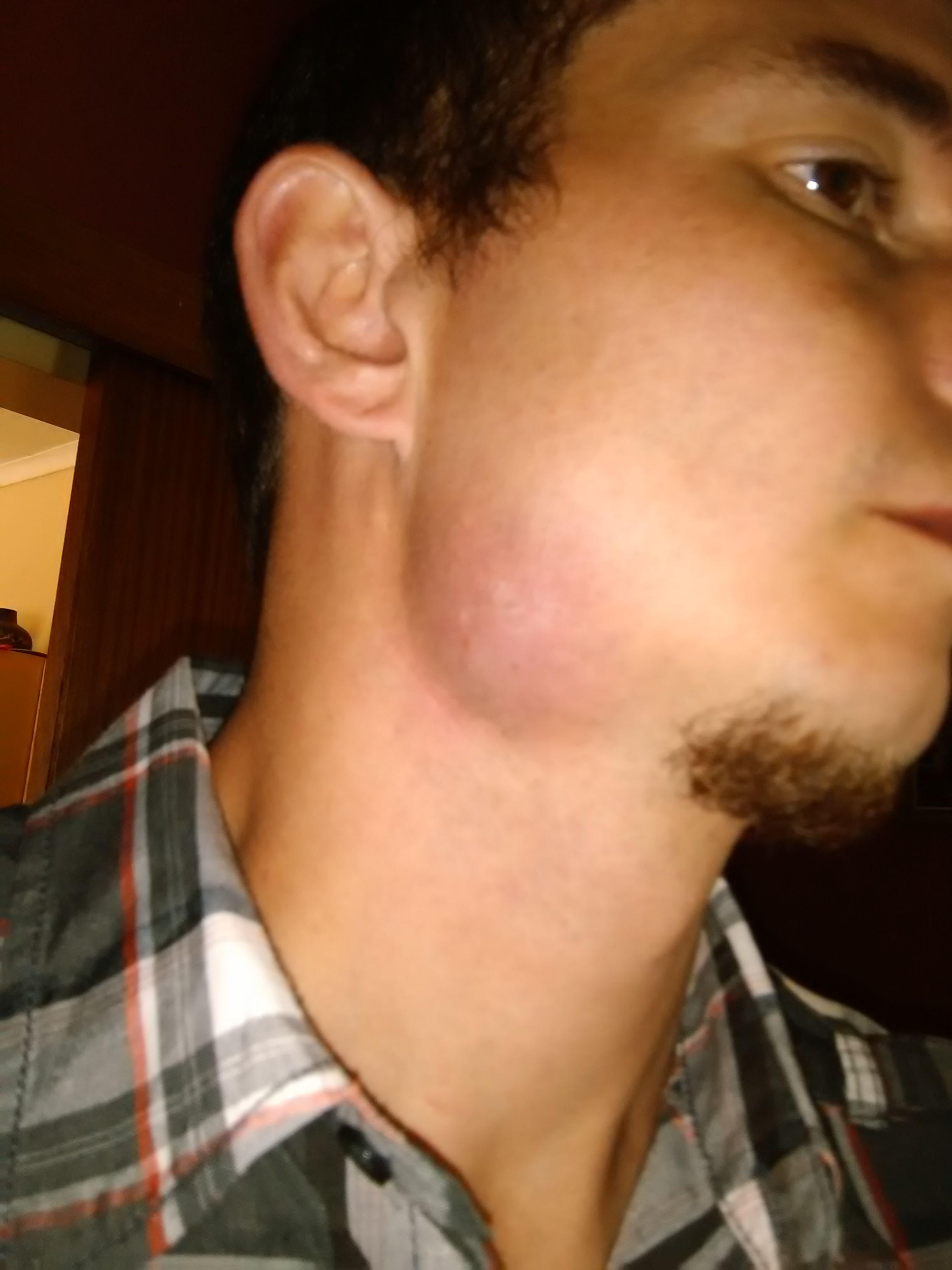 Name:  IMG_20151123_091500.jpg
Views: 984
Size:  309.4 KB