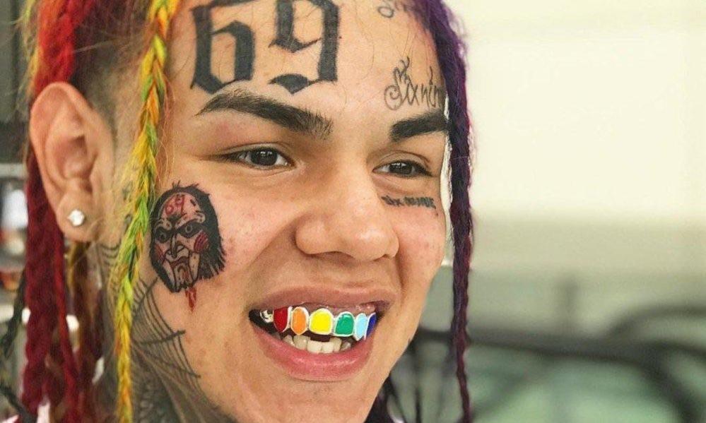 Name:  tekashiteeth-e1517941434861.jpg
Views: 62
Size:  74.5 KB